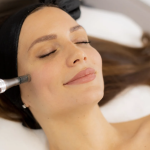 RF Microneedling With Morpheus8 in Rockville Maryland